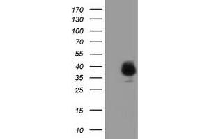 Western Blotting (WB) image for anti-Family with Sequence Similarity 84, Member B (FAM84B) antibody (ABIN1498215) (FAM84B Antikörper)