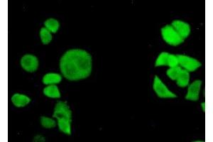 Detection of TNPO1 in Hela cells using Polyclonal Antibody to Transportin 1 (TNPO1) (Transportin 1 Antikörper  (AA 593-836))