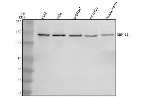 Western blot analysis of CEP135 using anti-CEP135 antibody (ABIN7601061).