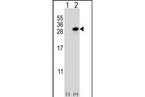Western blot analysis of CLTA (arrow) using rabbit polyclonal CLTA Antibody (Center) (ABIN652956 and ABIN2842611). (CLTA Antikörper  (AA 99-127))