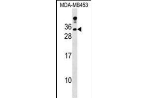 LIN7A antibody  (C-Term)