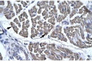 Immunohistochemical staining (Formalin-fixed paraffin-embedded sections) of human skeletal muscle with EYA3 polyclonal antibody  at 4-8 ug/mL working concentration. (EYA3 Antikörper  (Internal Region))