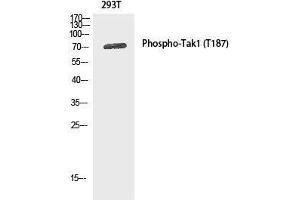 Western Blot analysis of 293T cells using Phospho-MAP3K7 (Thr187) Polyclonal Antibody at dilution of 1:1000 (MAP3K7 Antikörper  (pThr187))