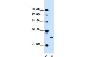 Western Blotting (WB) image for anti-Ring Finger Protein 39 (RNF39) antibody (ABIN2462699)