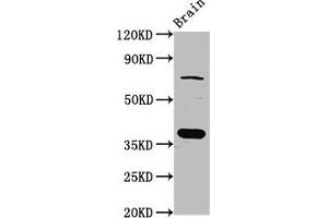 Western Blot Positive WB detected in: Rat brain tissue All lanes: SCAMP1 antibody at 4 μg/mL Secondary Goat polyclonal to rabbit IgG at 1/50000 dilution Predicted band size: 38, 19 kDa Observed band size: 38 kDa (SCAMP1 Antikörper  (AA 2-134))