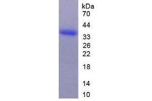 SDS-PAGE (SDS) image for Arginase, Type II (ARG2) (AA 23-354) protein (His tag) (ABIN1078904)