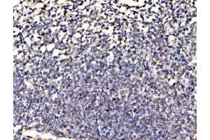 IHC analysis of Kinectin 1/KTN1 using anti-Kinectin 1/KTN1 antibody (ABIN7601096). (KTN1 Antikörper  (AA 283-827))