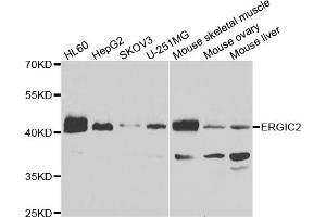 Western blot analysis of extracts of various cell lines, using ERGIC2 antibody (ABIN4903602) at 1:1000 dilution. (ERGIC2 Antikörper)