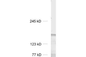 dilution: 1 : 1000, sample: rat brain homogenate (LRRC7 Antikörper  (AA 877-891, AA 1341-1357))