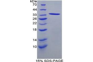 SDS-PAGE analysis of Rat ANGPTL1 Protein.