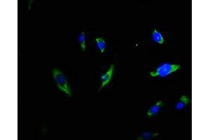 Immunofluorescence staining of U251 cells with ABIN7173353 at 1:66, counter-stained with DAPI. (Triadin Antikörper  (AA 75-161))