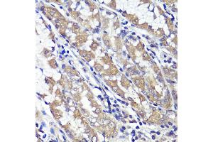 Immunohistochemistry of paraffin-embedded human stomach using UBL3 antibody (ABIN6131930, ABIN6149849, ABIN6149850 and ABIN6220468) at dilution of 1:100 (40x lens). (UBL3 Antikörper  (AA 1-117))