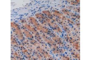 Used in DAB staining on fromalin fixed paraffin- embedded stomach tissue (Caspase 9 Antikörper  (AA 1-200))