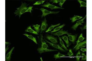 Immunofluorescence of purified MaxPab antibody to RARS on HeLa cell. (RARS Antikörper  (AA 1-660))