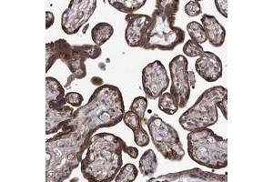 Immunohistochemical staining of human placenta with TJAP1 polyclonal antibody  shows strong granular cytoplasmic positivity in trophoblastic cells. (TJAP1 Antikörper)