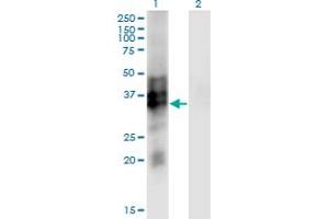 Western Blot analysis of SYP expression in transfected 293T cell line by SYP monoclonal antibody (M01), clone 3B3. (Synaptophysin Antikörper  (AA 1-313))