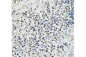 IHC analysis of AP2 Gamma/TFAP2C using anti-AP2 Gamma/TFAP2C antibody (ABIN7599099).