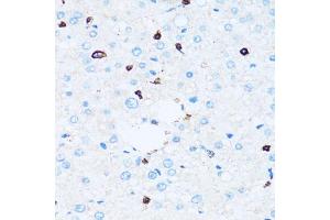 Immunohistochemistry of paraffin-embedded human liver using SPN antibody (ABIN5973813) at dilution of 1/100 (40x lens). (CD43 Antikörper)