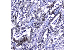 Immunohistochemistry (IHC) image for anti-Mdc1 (MDC1) (AA 534-626) antibody (ABIN5693232)