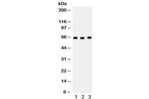 Western blot testing of human 1) HeLa, 2) U937 and 3) SW620 lysate with SLC19A1 antibody. (SLC19A1 Antikörper)
