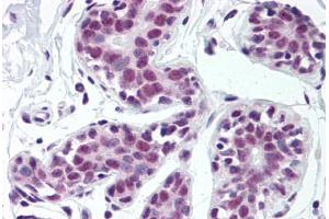 Human Breast (formalin-fixed, paraffin-embedded) stained with TARDBP antibody ABIN307182 at 5 ug/ml followed by biotinylated goat anti-rabbit IgG secondary antibody ABIN481713, alkaline phosphatase-streptavidin and chromogen. (TARDBP Antikörper  (Internal Region))