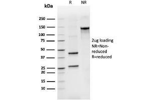 SDS-PAGE Analysis Purified BCL2L2 Mouse Monoclonal Antibody (CPTC-BCL2L2-2). (BCL2L2 Antikörper)