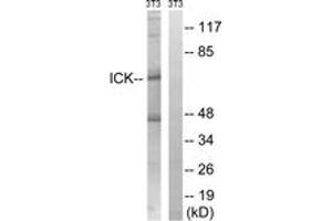 Western blot analysis of extracts from NIH-3T3 cells, treated with PBS 10uM 60', using ICK (Ab-159) Antibody. (ICK Antikörper  (AA 125-174))