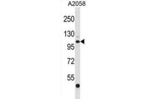 Western Blotting (WB) image for anti-ER Degradation Enhancer, Mannosidase alpha-Like 3 (EDEM3) antibody (ABIN2998830) (EDEM3 Antikörper)