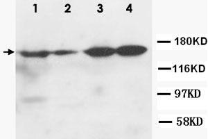 Western Blot analysis of ROCK2 expression from cell extracts with ROCK2 polyclonal antibody . (ROCK2 Antikörper  (N-Term))