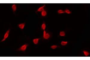 ABIN6268797 staining HT29 by IF/ICC. (EZH1 Antikörper  (Internal Region))
