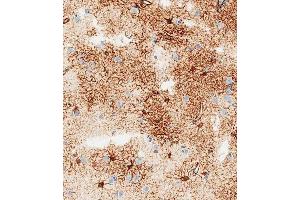 Immunohistochemical analysis of paraffin-embedded human brain tissue using B performed on the Leica® BOND RXm. (GFAP Antikörper)