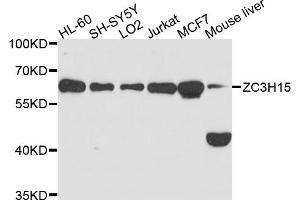 Western blot analysis of extracts of various cell lines, using ZC3H15 antibody (ABIN6003752) at 1/1000 dilution. (ZC3H15 Antikörper)
