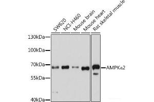 Western blot analysis of extracts of various cell lines using AMPKα2 Polyclonal Antibody at dilution of 1:1000. (PRKAA2 Antikörper)