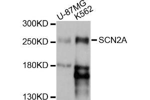 Western blot analysis of extracts of various cell lines, using SCN2A antibody (ABIN5998750) at 1/1000 dilution. (SCN2A Antikörper)