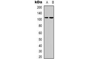 Western blot analysis of Thrombospondin 4 expression in A431 (A), HEK293T (B) whole cell lysates.