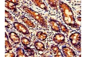 Immunohistochemistry of paraffin-embedded human small intestine tissue using ABIN7174631 at dilution of 1:100 (UGT1A9 Antikörper  (AA 277-473))