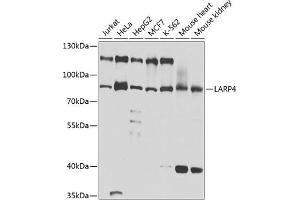 Western blot analysis of extracts of various cell lines, using L antibody (ABIN6132079, ABIN6143092, ABIN6143093 and ABIN6220849) at 1:1000 dilution. (LARP4 Antikörper  (AA 1-120))