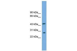 RABEPK antibody used at 1 ug/ml to detect target protein.