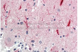 Rabbit Anti-GABRG2 Antibody Catalog Number: ARP36738_P050 Formalin Fixed Paraffin Embedded Tissue: Human Adult Brain, cerebellum  Observed Staining: Cytoplasm in hepatocytes Primary Antibody Concentration: 1:600 Secondary Antibody: Donkey anti-Rabbit-Cy3 Secondary Antibody Concentration: 1:200 Magnification: 20X Exposure Time: 0. (GABRG2 Antikörper  (N-Term))