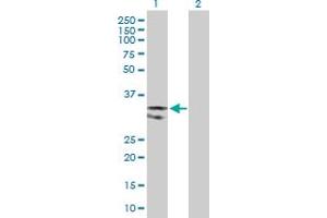 Western Blot analysis of UNG expression in transfected 293T cell line by UNG MaxPab polyclonal antibody. (UNG Antikörper  (AA 1-304))