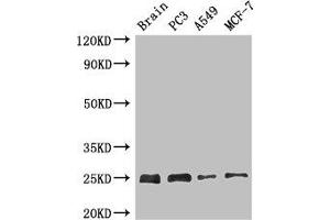Western Blot Positive WB detected in: Mouse brain tissue, PC-3 whole cell lysate, A549 whole cell lysate, MCF-7 whole cell lysate All lanes: APOPT1 antibody at 2. (APOPT1 Antikörper  (AA 40-150))