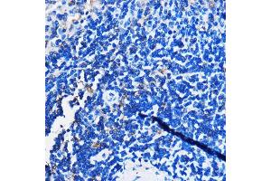 Immunohistochemistry (IHC) image for anti-Hydroxycarboxylic Acid Receptor 3 (HCAR3) antibody (ABIN7267805)