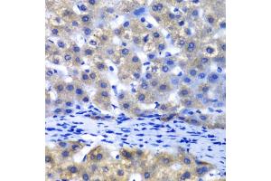 Immunohistochemistry of paraffin-embedded human liver injury using PSMD8 antibody. (PSMD8 Antikörper)