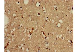 Immunohistochemistry of paraffin-embedded human brain tissue using ABIN7164093 at dilution of 1:100 (PRDM2 Antikörper  (AA 733-961))