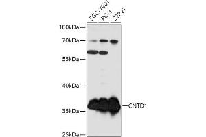 Western blot analysis of extracts of various cell lines, using CNTD1 antibody (ABIN7266574) at 1:1000 dilution. (CNTD1 Antikörper  (AA 1-120))