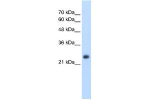 WB Suggested Anti-NNMT Antibody Titration:  2. (NNMT Antikörper  (N-Term))