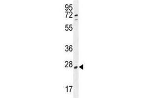 RPEL1 antibody western blot analysis in K562 lysate (Ribulose-5-Phosphate-3-Epimerase-Like (RPEL1) (AA 187-215) Antikörper)