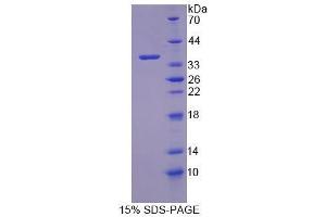 SDS-PAGE (SDS) image for Cyclin-Dependent Kinase 18 (CDK18) (AA 121-402) protein (His tag) (ABIN6239466) (CDK18 Protein (AA 121-402) (His tag))