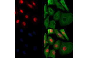 Phospho-SAMHD1 (Thr592) Antibody staining A549 cells(H2O2 treatment) by IF/ICC. (SAMHD1 Antikörper  (pThr592))