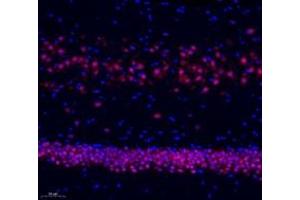 Immunofluorescence of paraffin embedded rat hippocampus using neun (ABIN7075479) at dilution of 1: 500 (200x lens) (NeuN Antikörper)